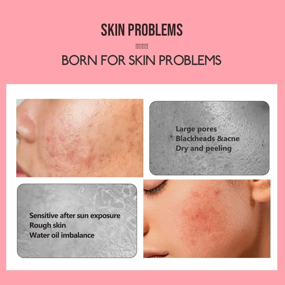 Rose Water, Toner, Rosevann med Trollhassel og Aloe Vera